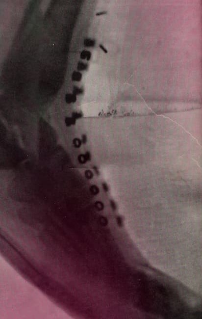 x-rays nikola tesla